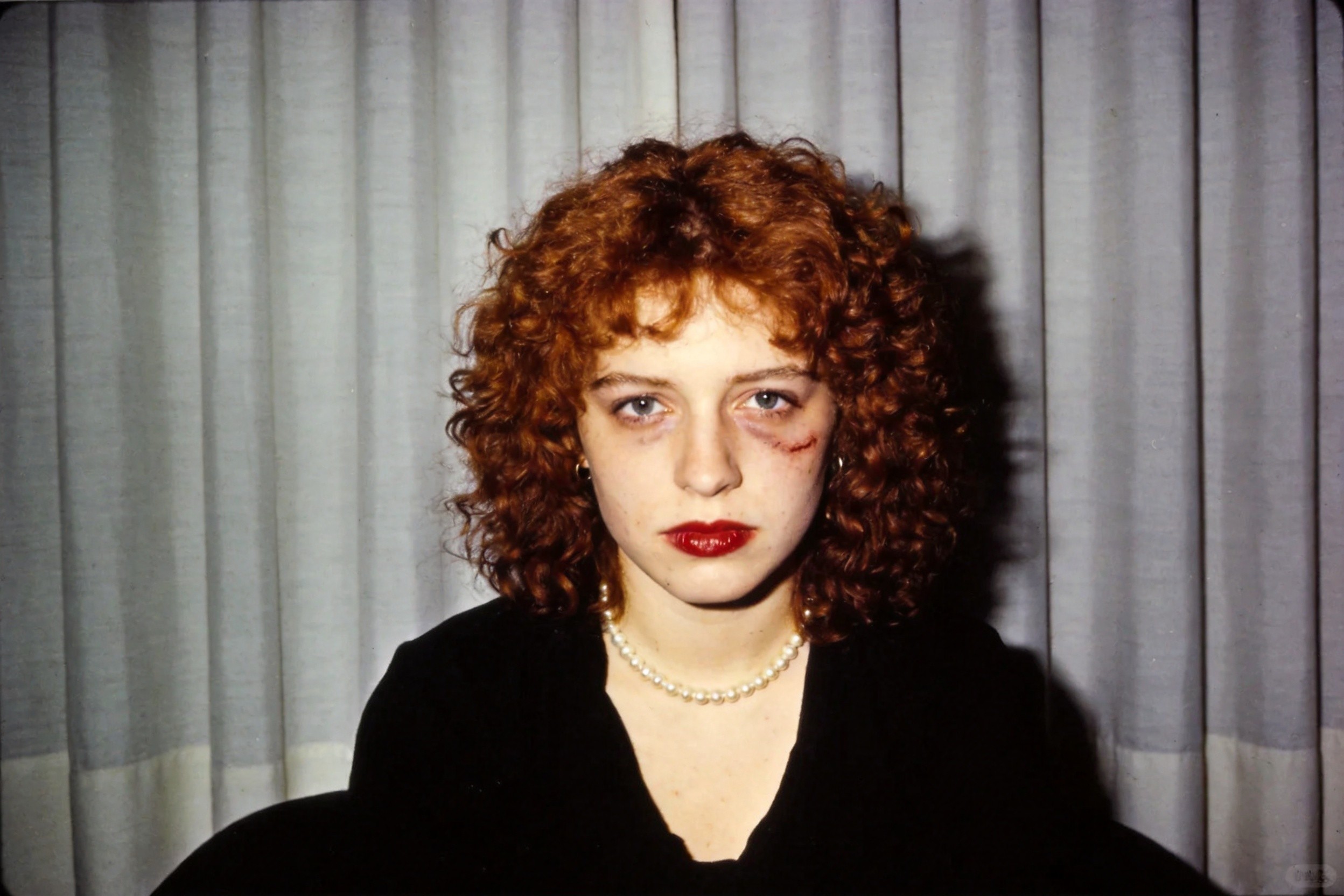 Nan one month after being battered, 1984 参考构图